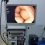 11:56 Sistem nou de endoscopie digestivă, pus în funcțiune la SJU Târgu-Jiu